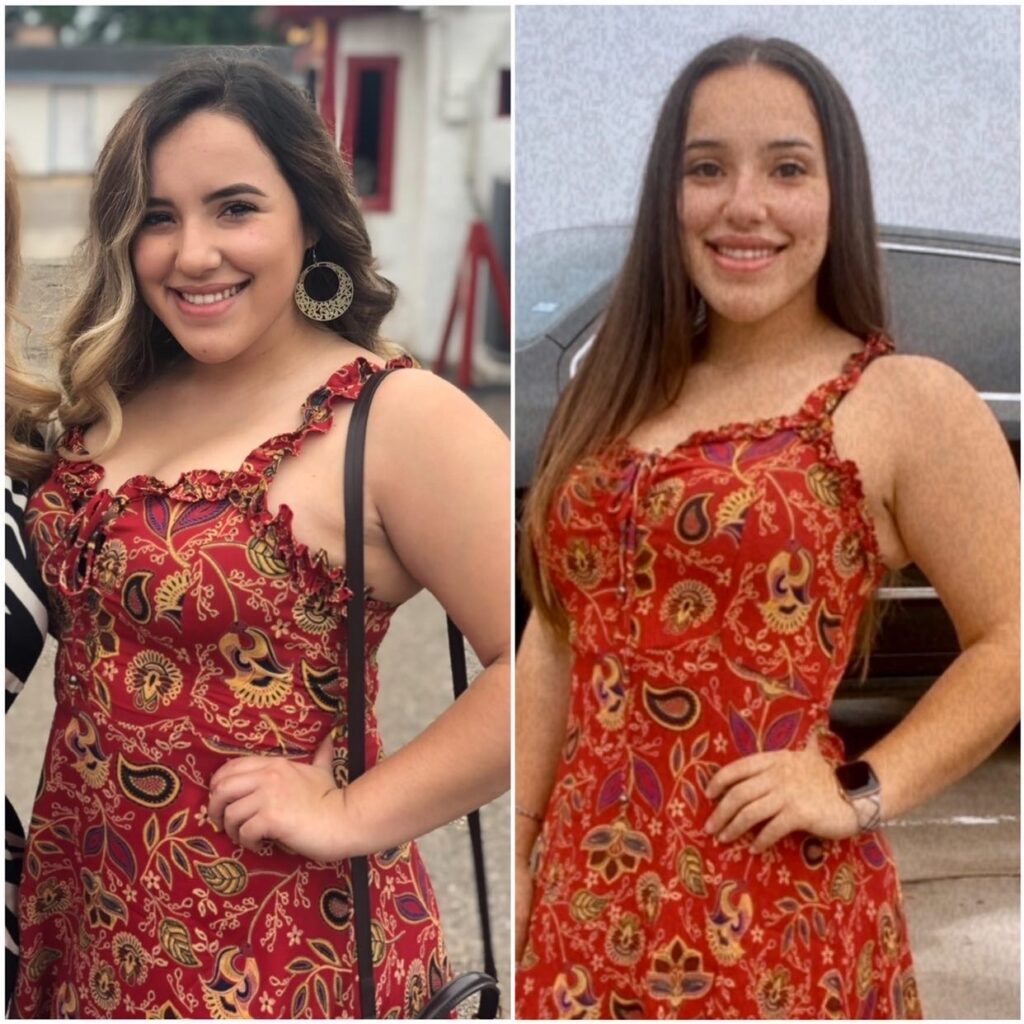 weight loss before and after 25